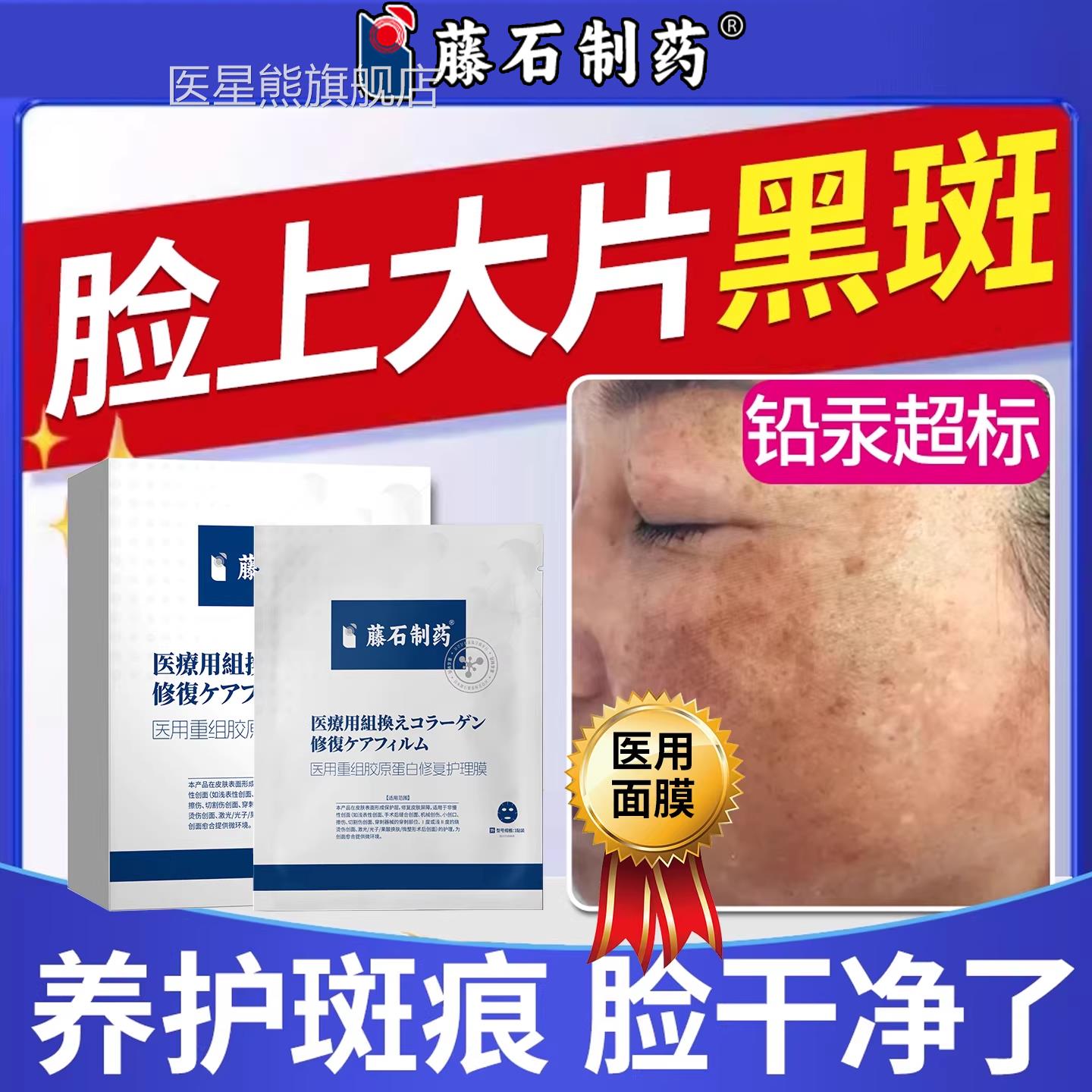 药房同售汞斑黑斑美淡斑面膜黄褐斑去除色斑贴淡白化色素中SK医星