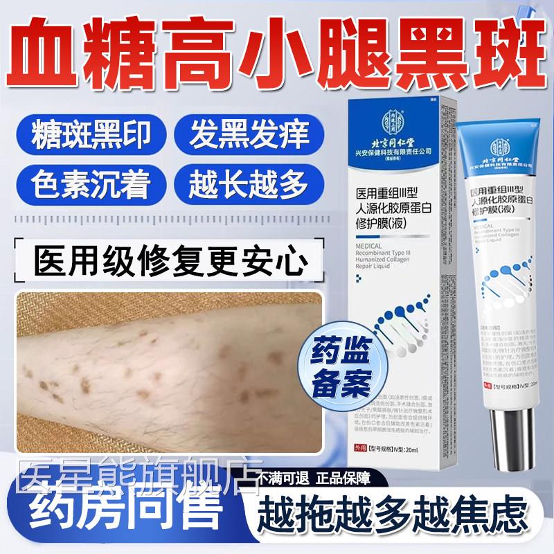 血糖高小胫前黑斑糖尿病疤痕印去除糖斑专用皮肤痒药腿房同售膏QQ