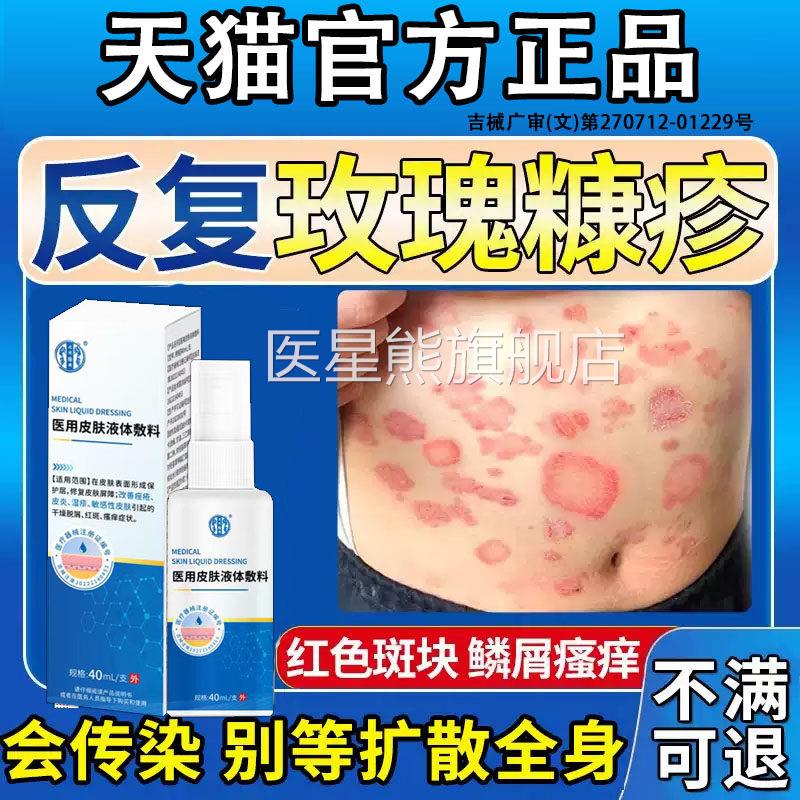 玫瑰糠疹喷雾专用皮肤瘙痒B抓破创面护理红斑鳞屑搭沐浴露膏药贴D