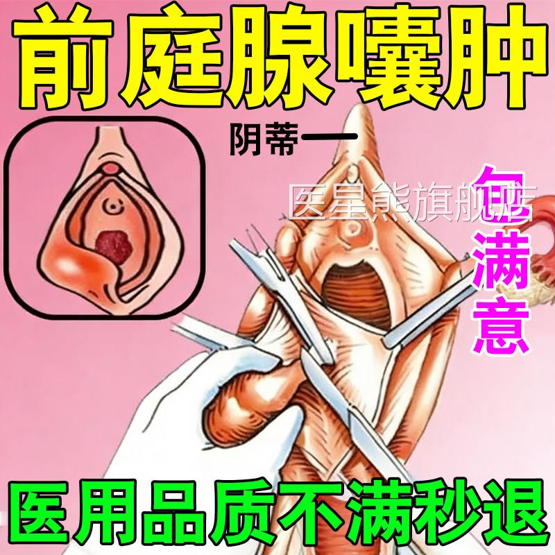 前庭大腺囊肿巴氏外阴有疙瘩非疏通消除火疖子肿腺痛脓包硬块痘痘