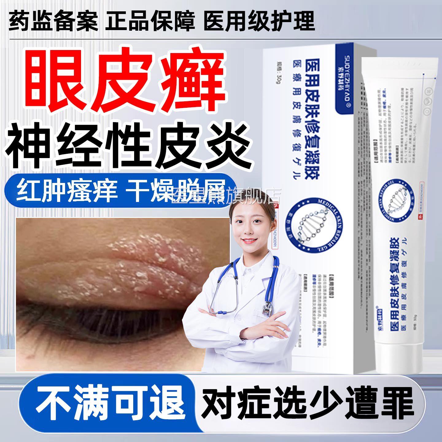眼皮癣神掉经性皮炎眼睛周围过敏发痒眼皮红肿痒眼角干燥起皮屑Y7