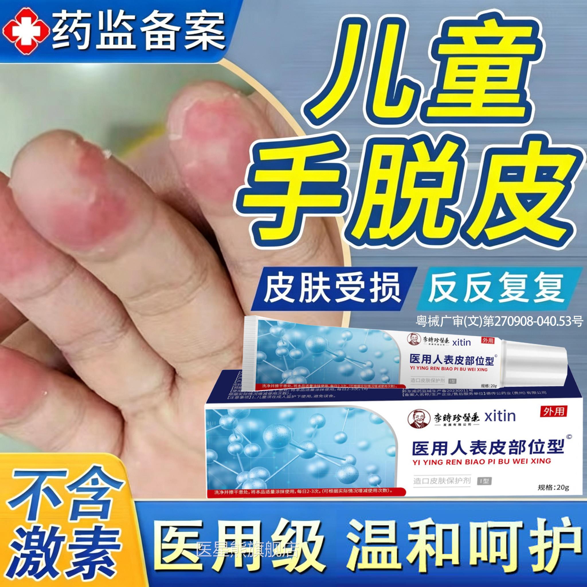 儿童手指脱皮严重用真菌蜕皮干燥起皮手足专痒起小水泡指头开裂PP