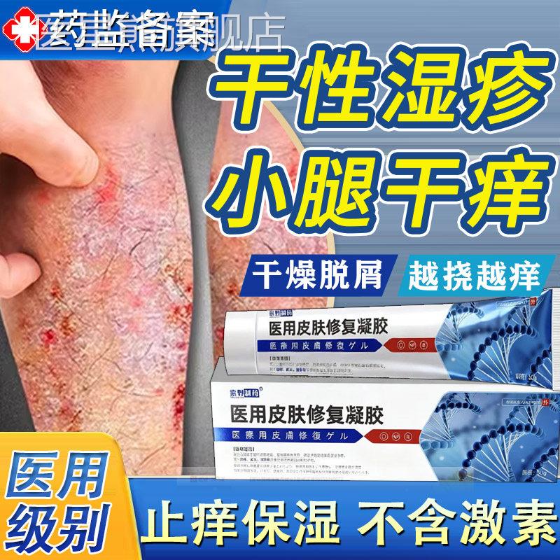 冬天腿痒小腿皮肤干燥瘙痒药膏干儿性湿疹掉皮屑童顽固皮炎止痒TK