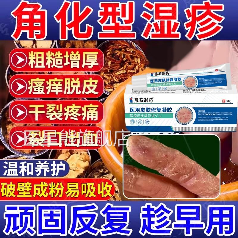 角化型湿疹手癣泡手包药染房同款脱皮干裂真菌感皲裂性手脚膏CA医