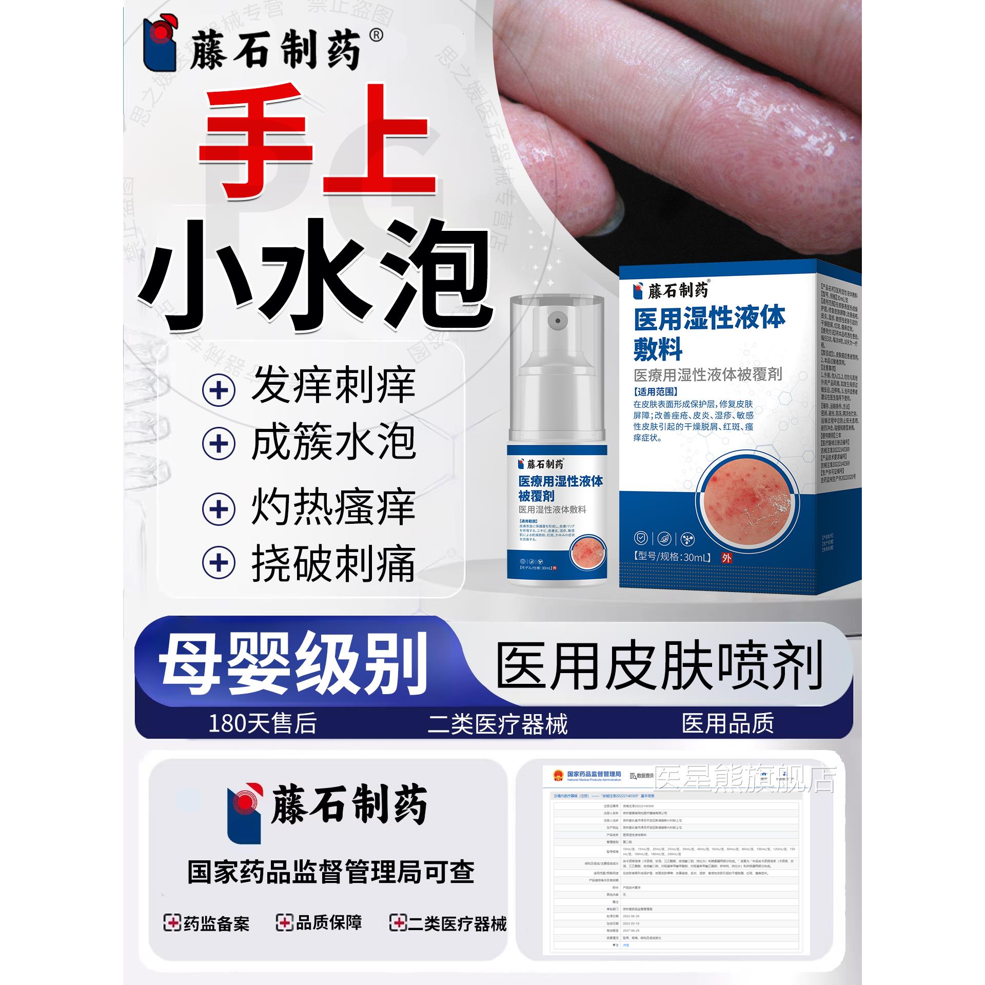 藤石制药手上汗疱疹止痒皮炎湿疹瘙痒儿童起小水泡P喷剂汗状疱疹G