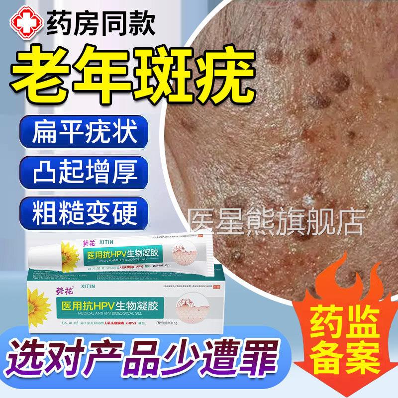 脸上扁平疣专用老年增厚凸起老人疣一抹灵专用斑脸部黑斑去除膏UU