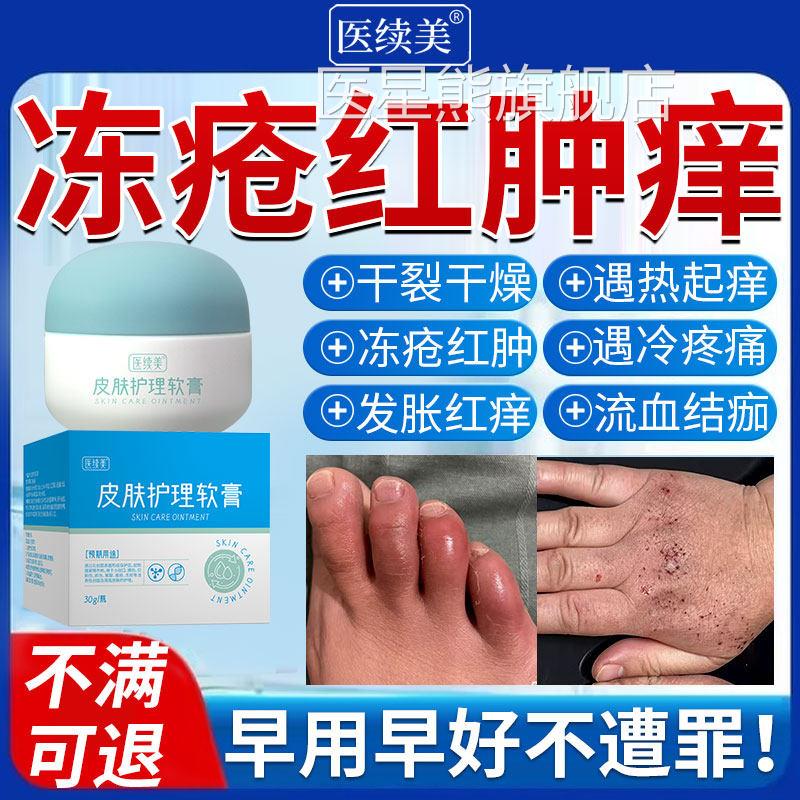 医用冻疮膏止痒冻伤膏儿童成人耳朵脸部冻冬天皮肤开裂红肿膏S裂K