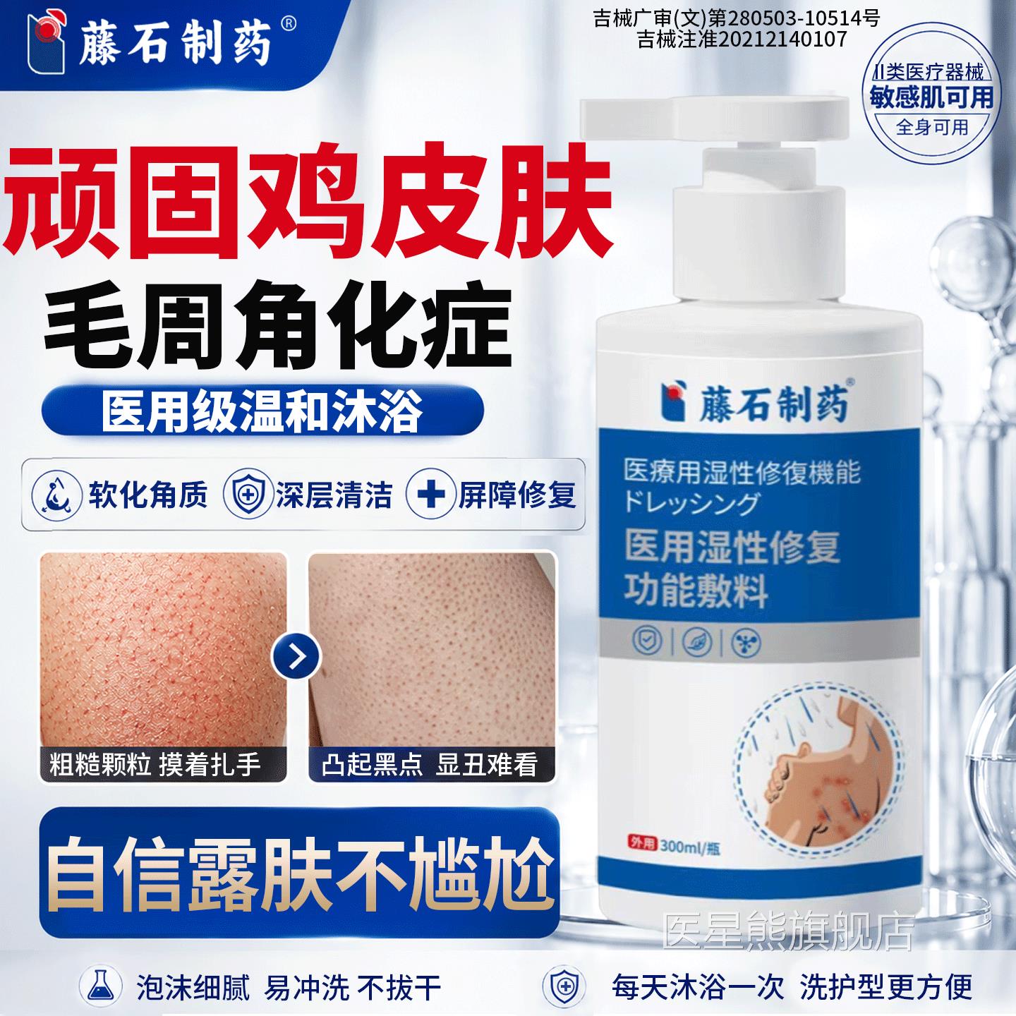 手臂鸡皮肤疙瘩毛囊角化症去同除全身胳膊沐浴露医用药房售儿童QK