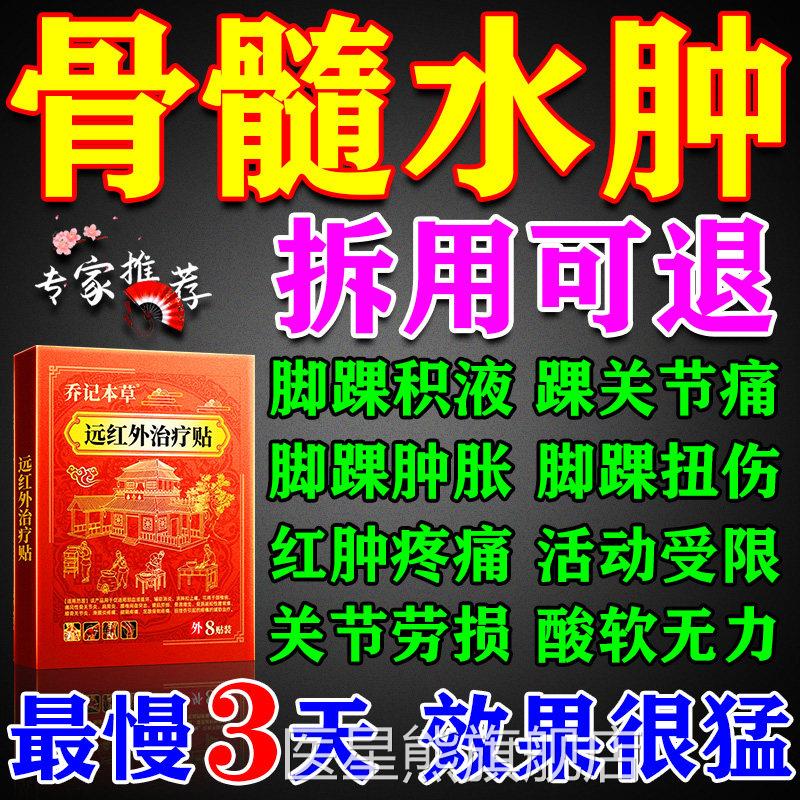 脚踝骨髓水肿热敷贴消肿化瘀脚扭腕疼痛崴脚韧带损伤积液专用膏药