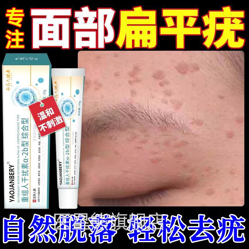 干扰素b2疣凝胶去疣药膏扁平丝状神器去除膏一抹灵面颈部专用UU医