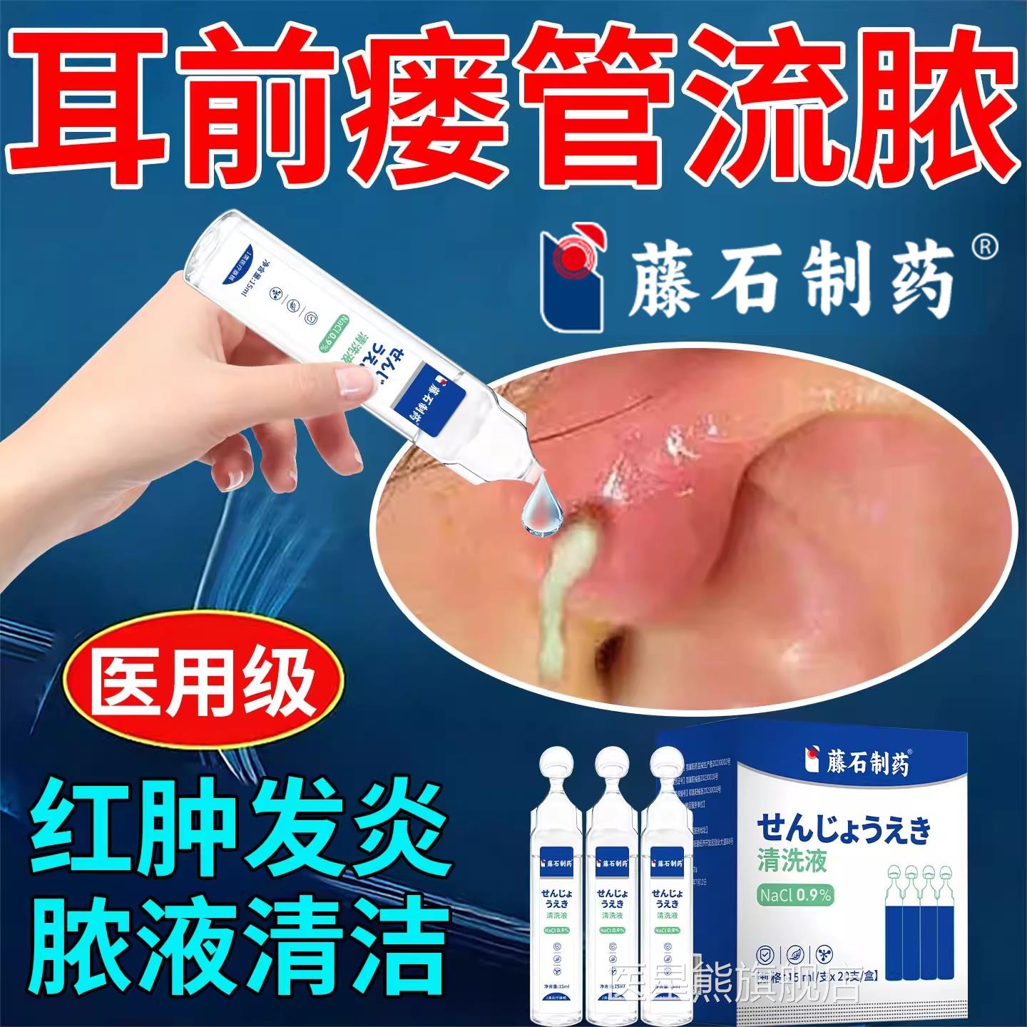 耳前瘘管冲洗发炎流脓清洗工具医用S洗耳朵耳道冲洗液灌洗耳朵K医
