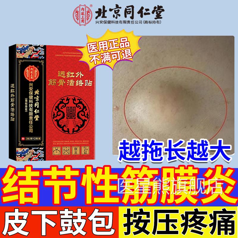 结节性筋膜炎手臂小腿特皮鼓包效肿块肌肉拉伤硬结疼下痛膏药贴CA