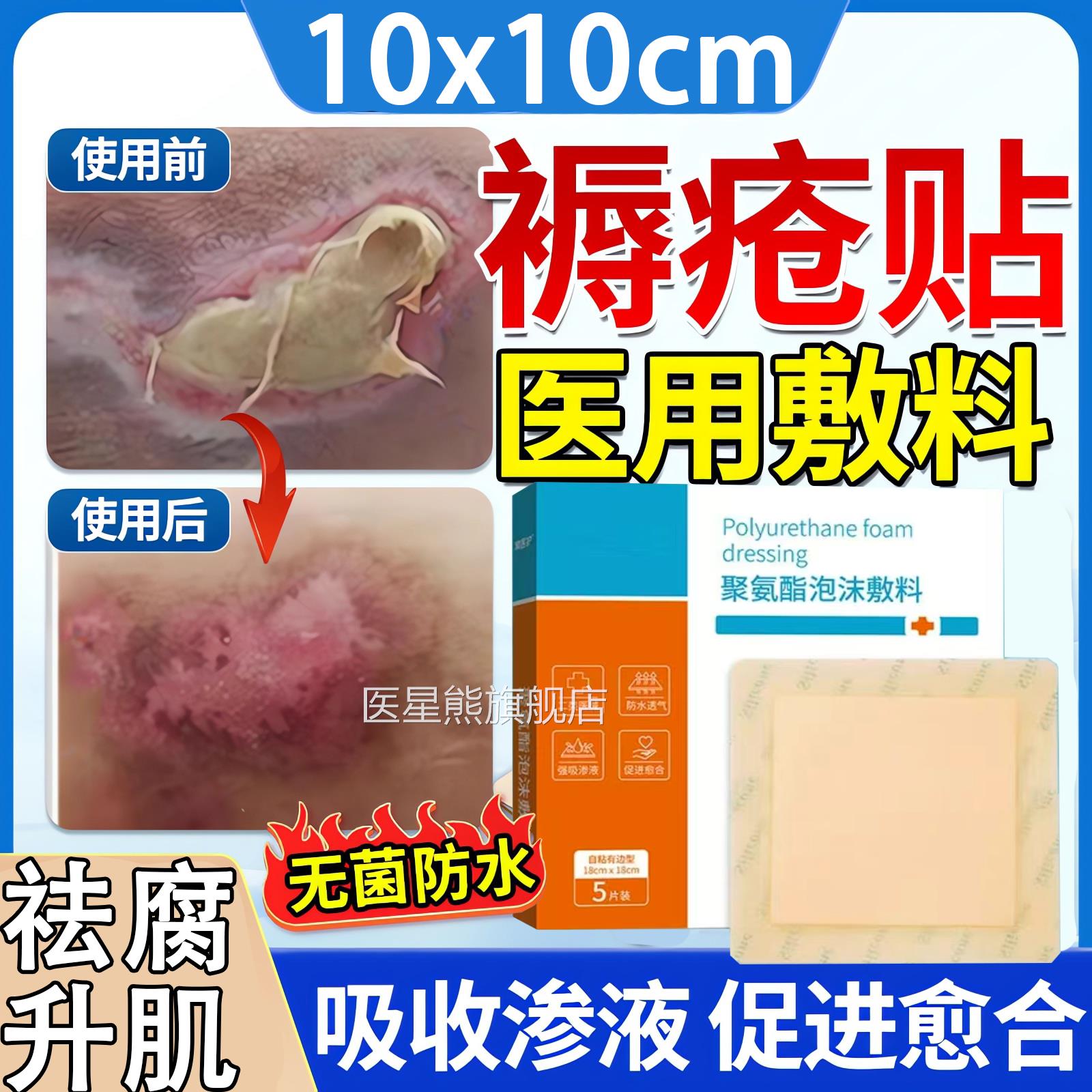 甲壳胺医用敷料泡沫辅料褥疮贴用褥疮专用医贴卧床老人防压疮甲克