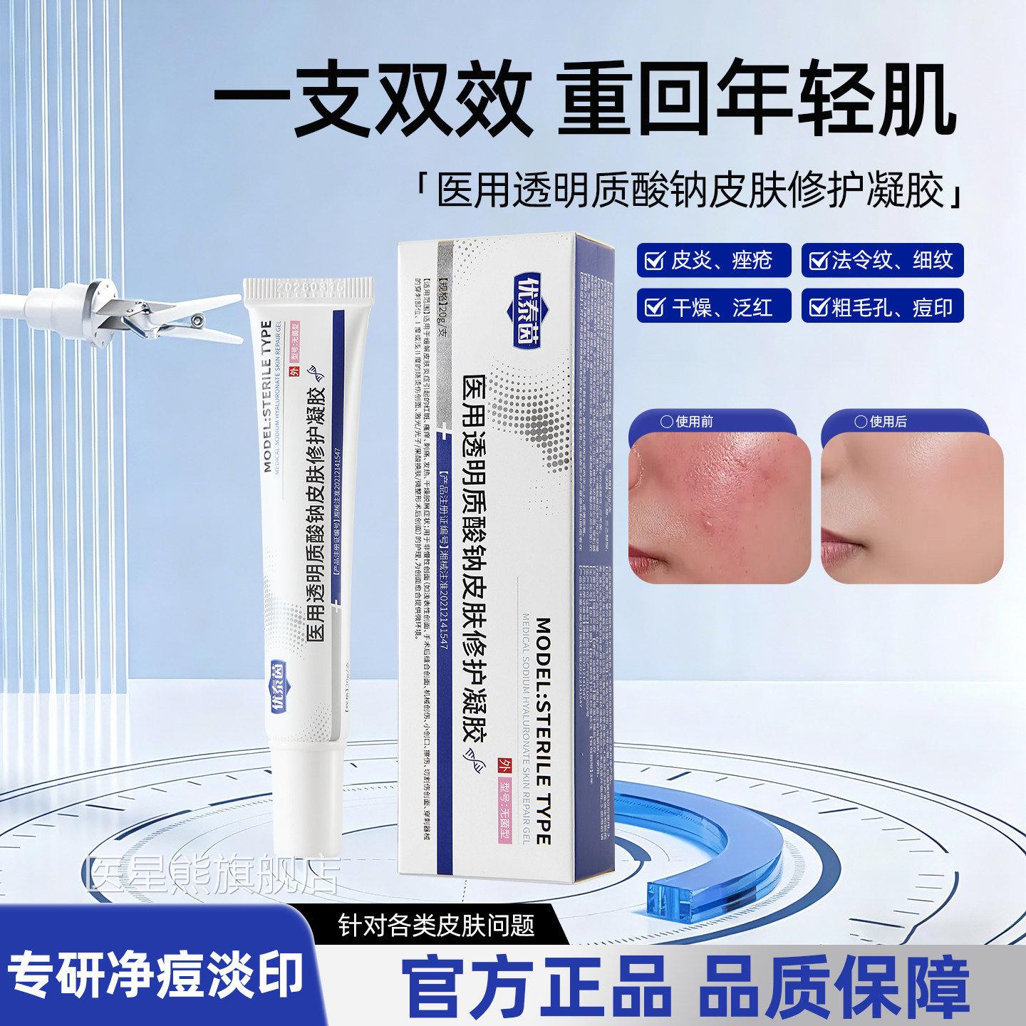 ytay小白管优泰茵去透痘印毛孔痤疮明质酸钠痘痘医用修护凝胶9tl