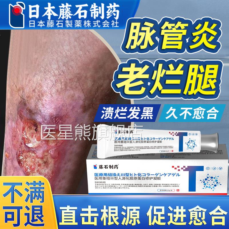 脉管炎老烂腿专用静烂脉曲张脚溃烂伤口愈合去腐生肌膏药监备案OM