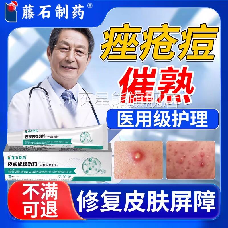 痘痘催熟膏面部下巴反复长痘硬瘩结节硬块淋巴痘腮疙边痘内修复SK