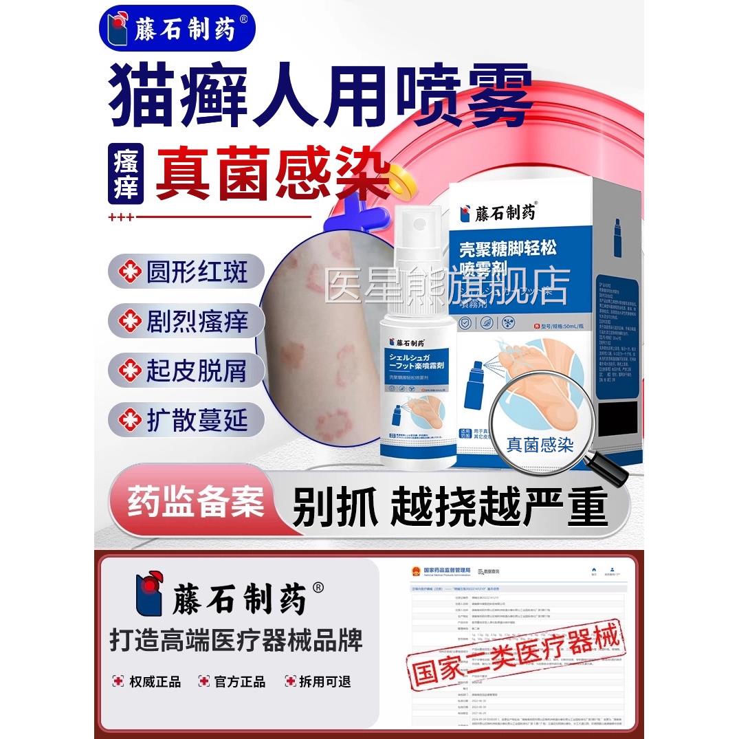 猫癣人用房同售人得猫藓专铜钱癣体药癣真菌感染皮肤瘙痒红花斑ZF