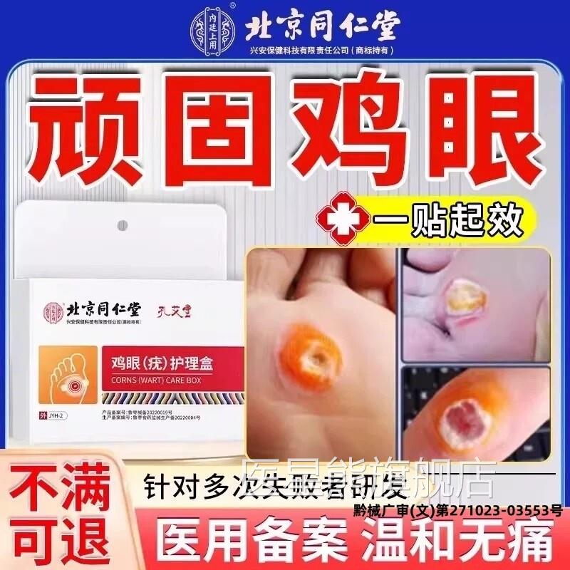 北京同仁堂脚鸡眼膏贴手根医用型官方除店旗舰肉刺跖疣瘊子药膏去