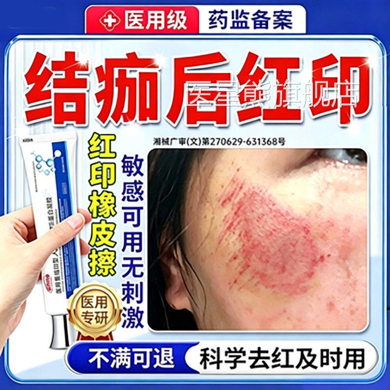擦伤摔伤结痂后疤痕修复除疤膏去黑淀色素沉点痣去红印退红淡印FY