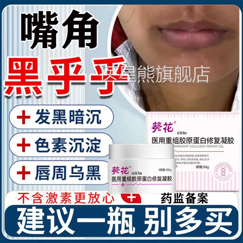 嘴角发黑黑色素沉淀去除改善唇黑唇黑嘴角暗沉唇炎周色素沉着膏LT