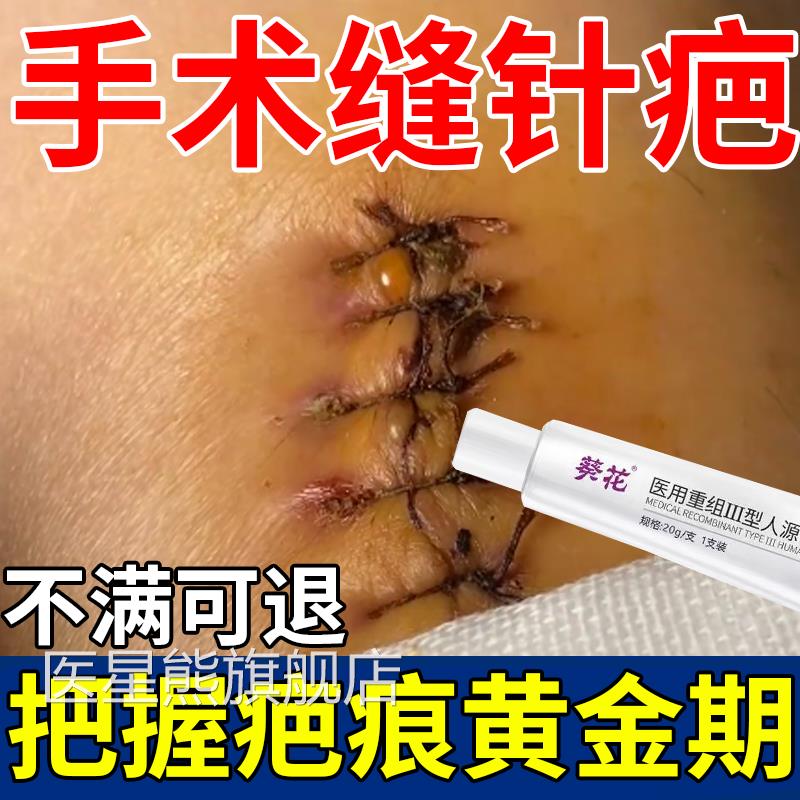 缝针疤痕修除疤膏手术复伤口刀口祛疤贴手术后伤疤痕平去增生凸起