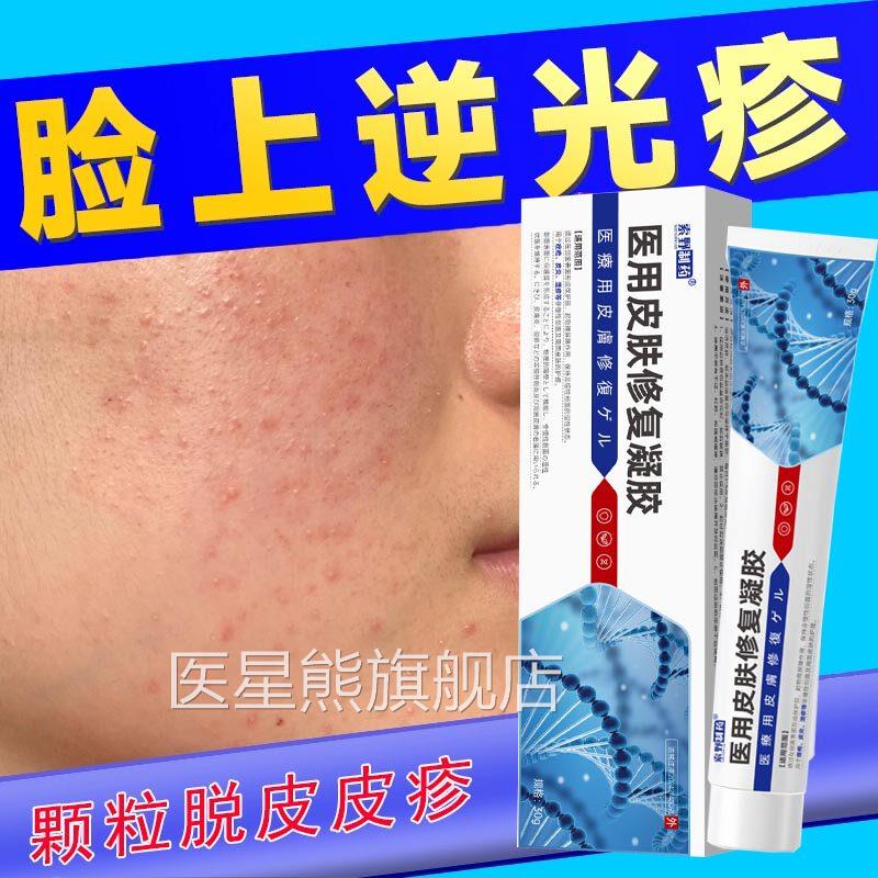 脸上脸额头上起小疙瘩小颗粒屏障修复逆光疹去除部闭口粉刺RS医星