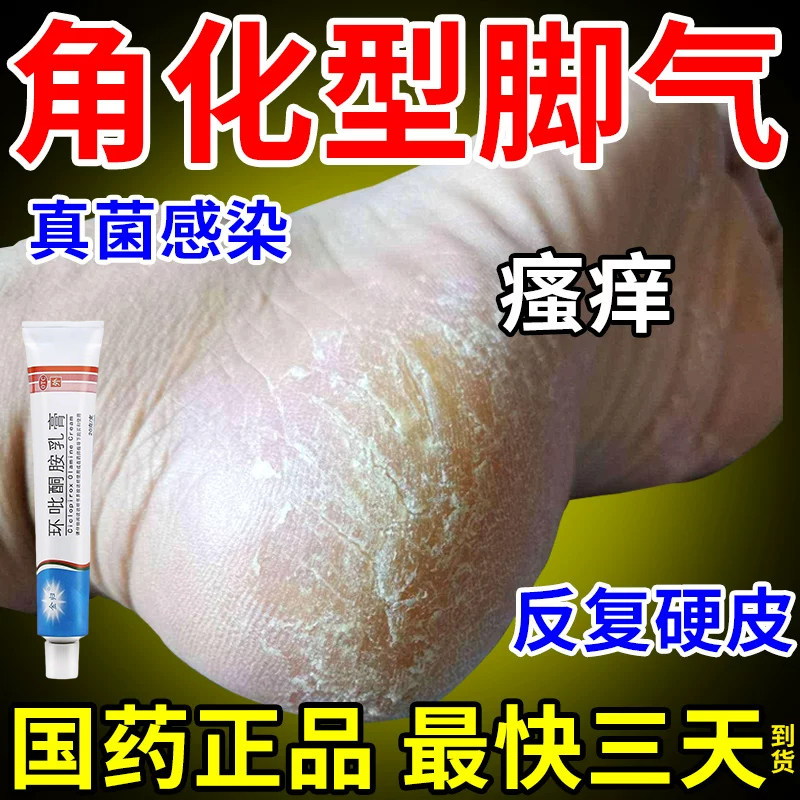 【金归】环吡酮胺乳膏1%*20g*1支/盒