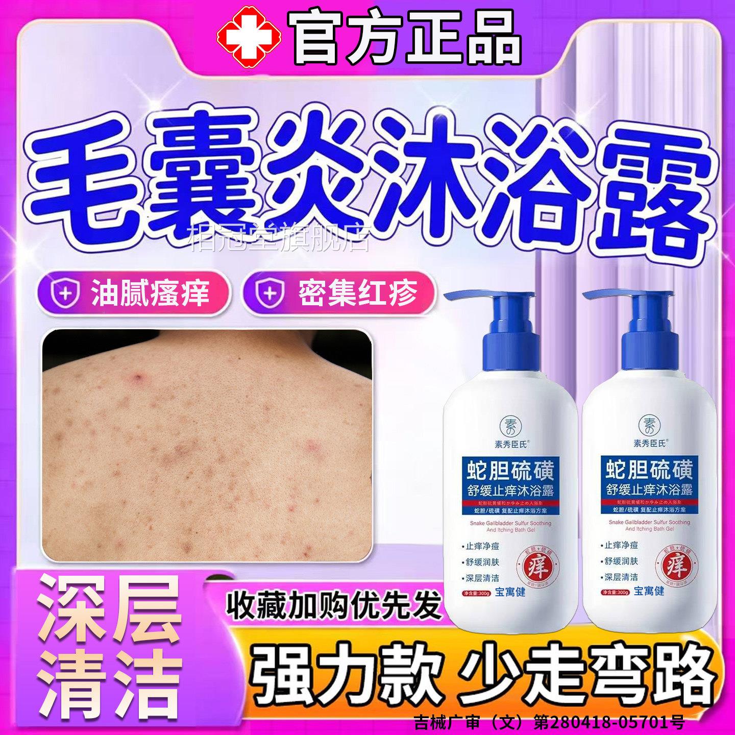 前胸后背毛囊炎除背上长痘痘沐浴露马拉色菌除螨祛痘去痒手臂疙瘩