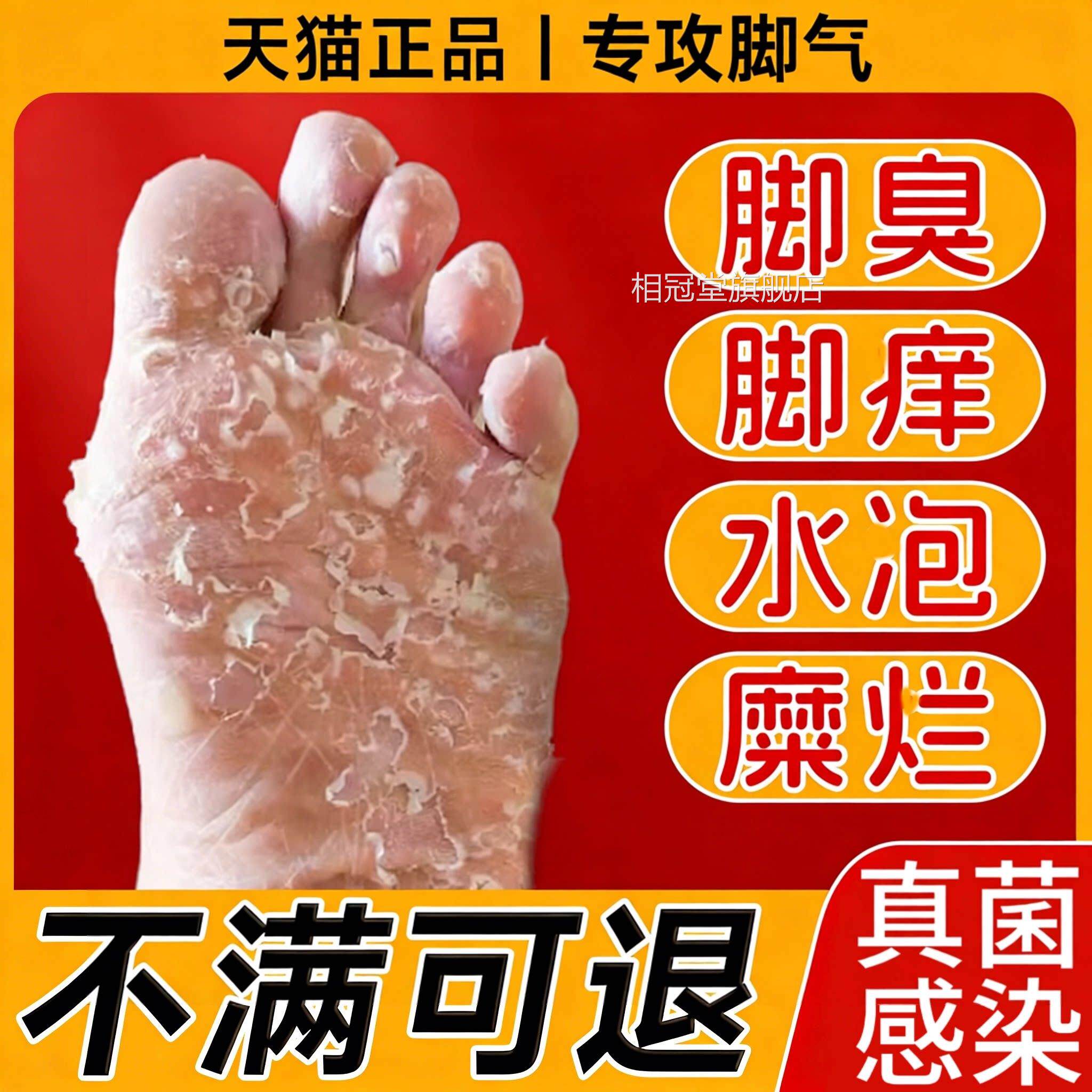 日本狼毒喷气雾烂脚丫脱糜皮烂杀菌止痒真菌感染脚趾缝痒套脚装相