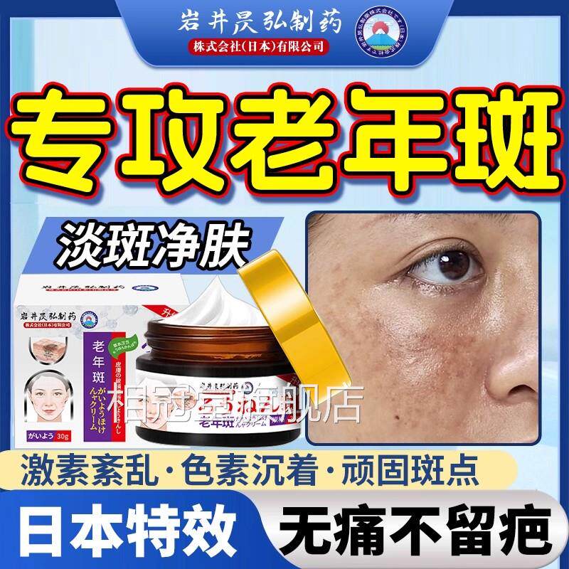 去老人斑专用膏除黑强力去除抹中药手部老年斑净老人斑一擦祛就掉