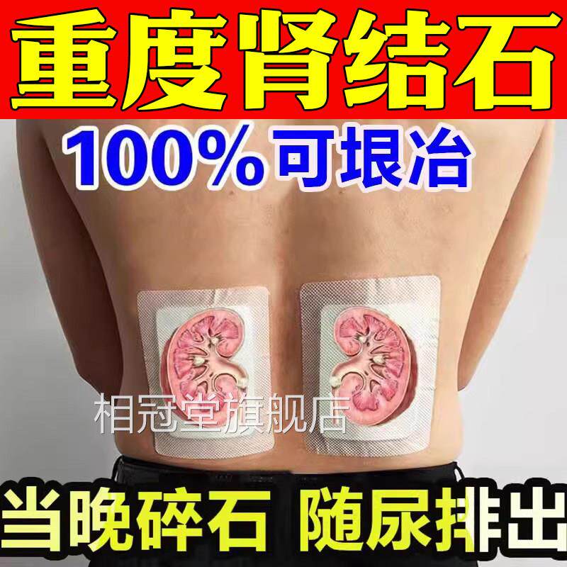 肾结石专用特效非药肾结石溶化石排石贴结石金钱草石茶中草药颗粒