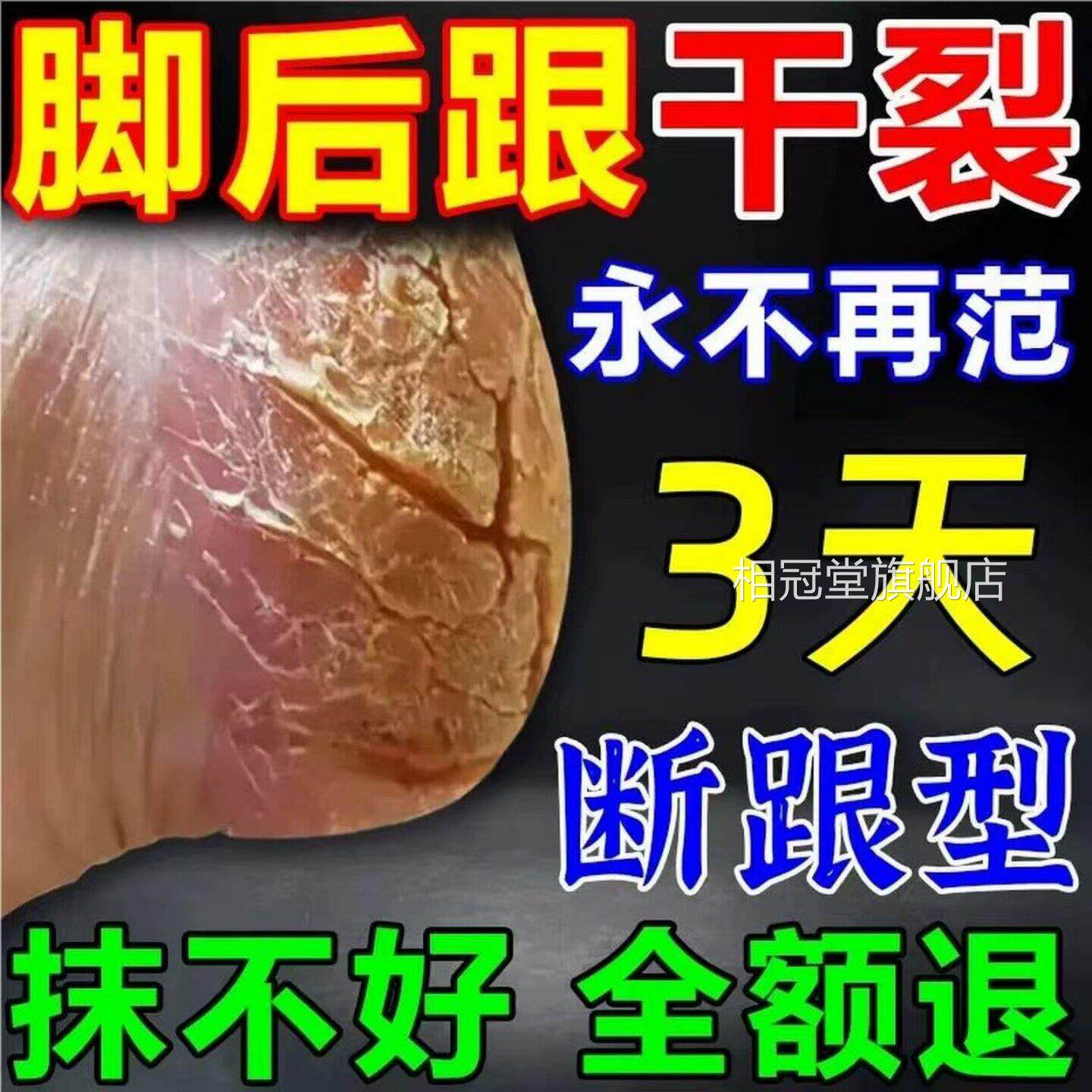 脚后跟干跟裂起硬皮足开裂修复霜专治防手足干裂皲裂膏护脚的药膏