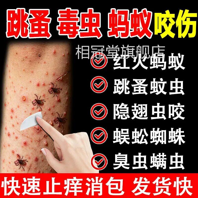 跳蚤咬止痒膏红肿用蚂咬伤膏消肿蚊虫叮咬成人蚁儿童正品官方相冠