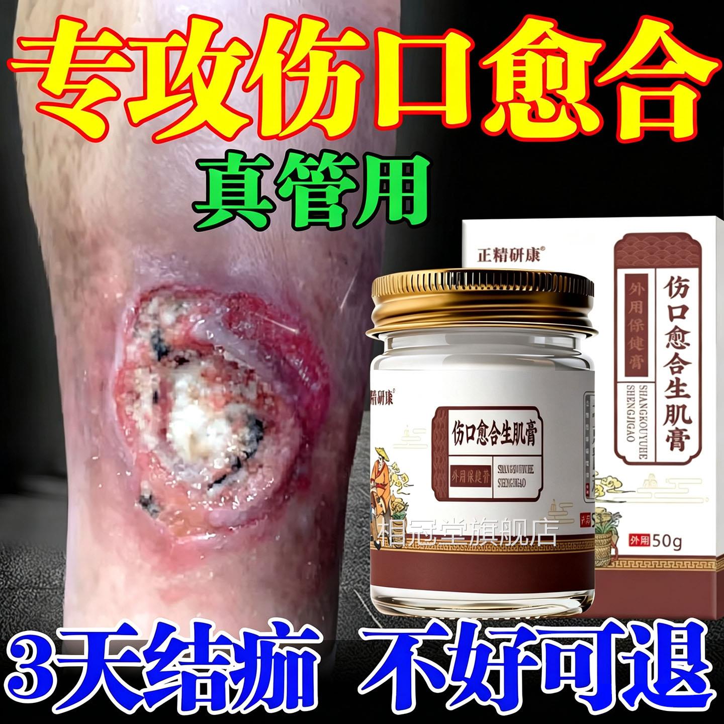 伤口愈合促进长肉溃疡感染快速结痂消i炎去炎腐生肌脉管足i专用膏