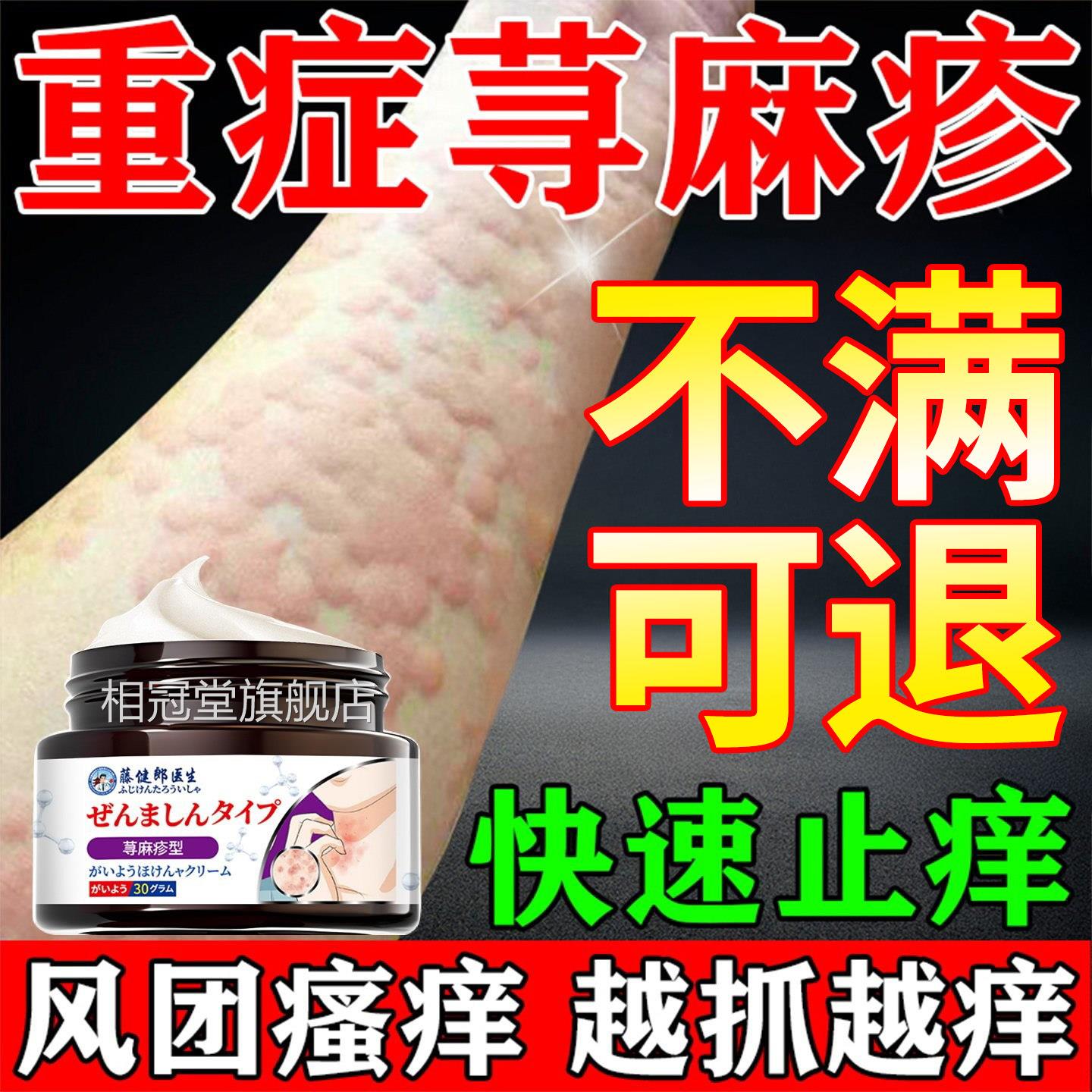 日本荨麻疹过敏止痒膏胆碱能性肤日光性风团性荨麻膏皮瘙痒止痒膏