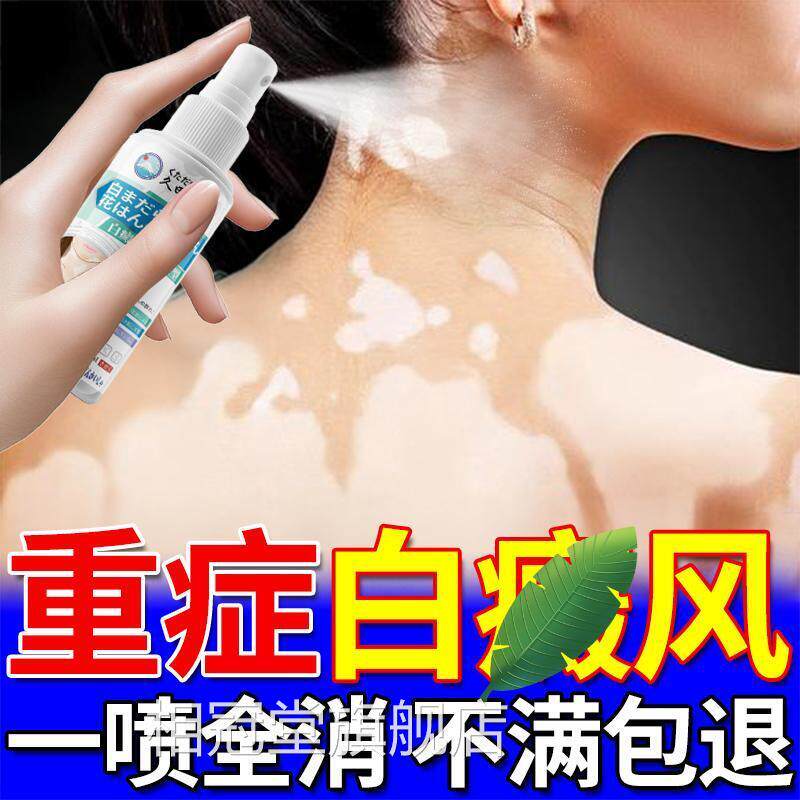 白净白风克星生汗殿斑白色净汗斑净补骨脂酊外用黑色素中老年专用
