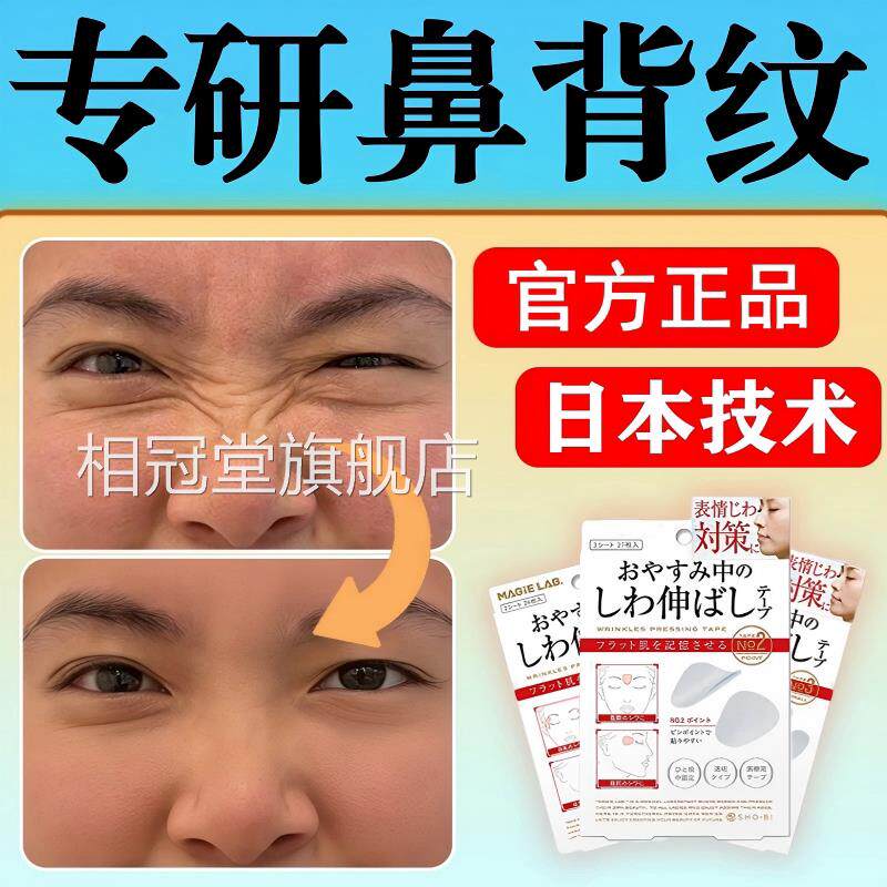 日本鼻梁皱消纹贴鼻背纹贴去除淡化除祛横线专用面部肌肉额川y相