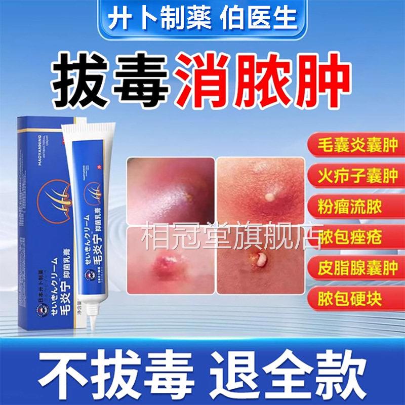疖肿断火痒拔毒膏疖子的囊肿痛脓包皮脂腺痘痘痒私处外阴囊毛囊炎
