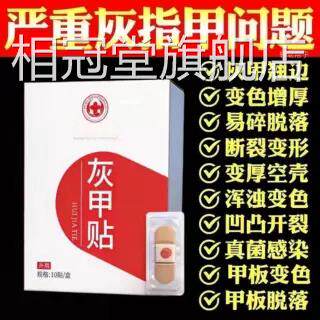 正香港灰i指i甲贴官方旗舰品指甲养护医用级脚趾手指甲专用相冠堂