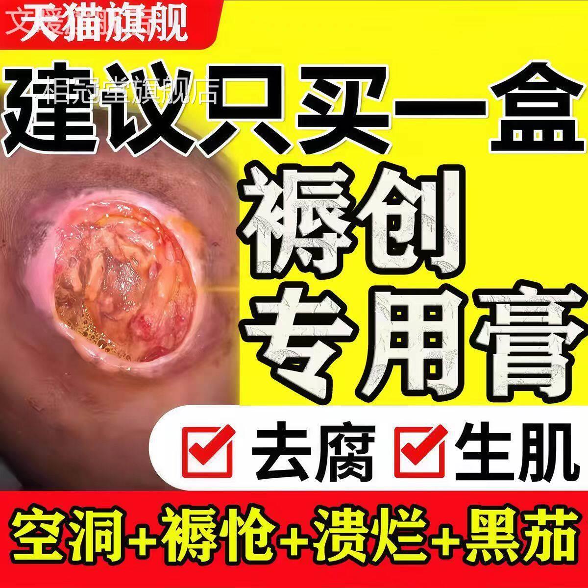 日本褥疮膏口促进长肉防压疮卧伤床瘫痪老人臀部外用专用特药膏效