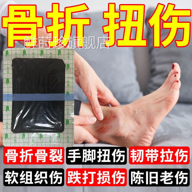 骨折结骨黑膏贴骨裂结骨膏黑玉断续膏促生长韧带拉崴跌扭老黑膏贴
