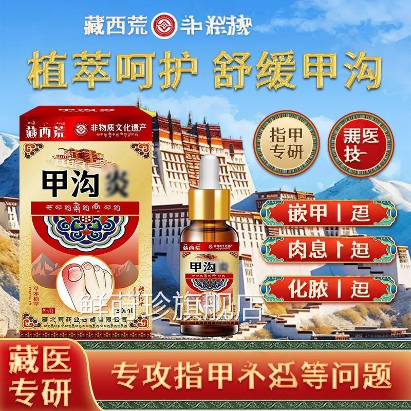 藏西荒甲夹沟炎辅助治疗专用效特大药房神器脚趾根甲往肉里长手指