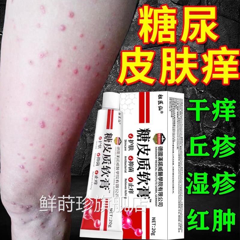 糖尿病皮肤痒专止膏痒治老年人并发症高皮血糖肤护理膏鲜莳珍旗舰
