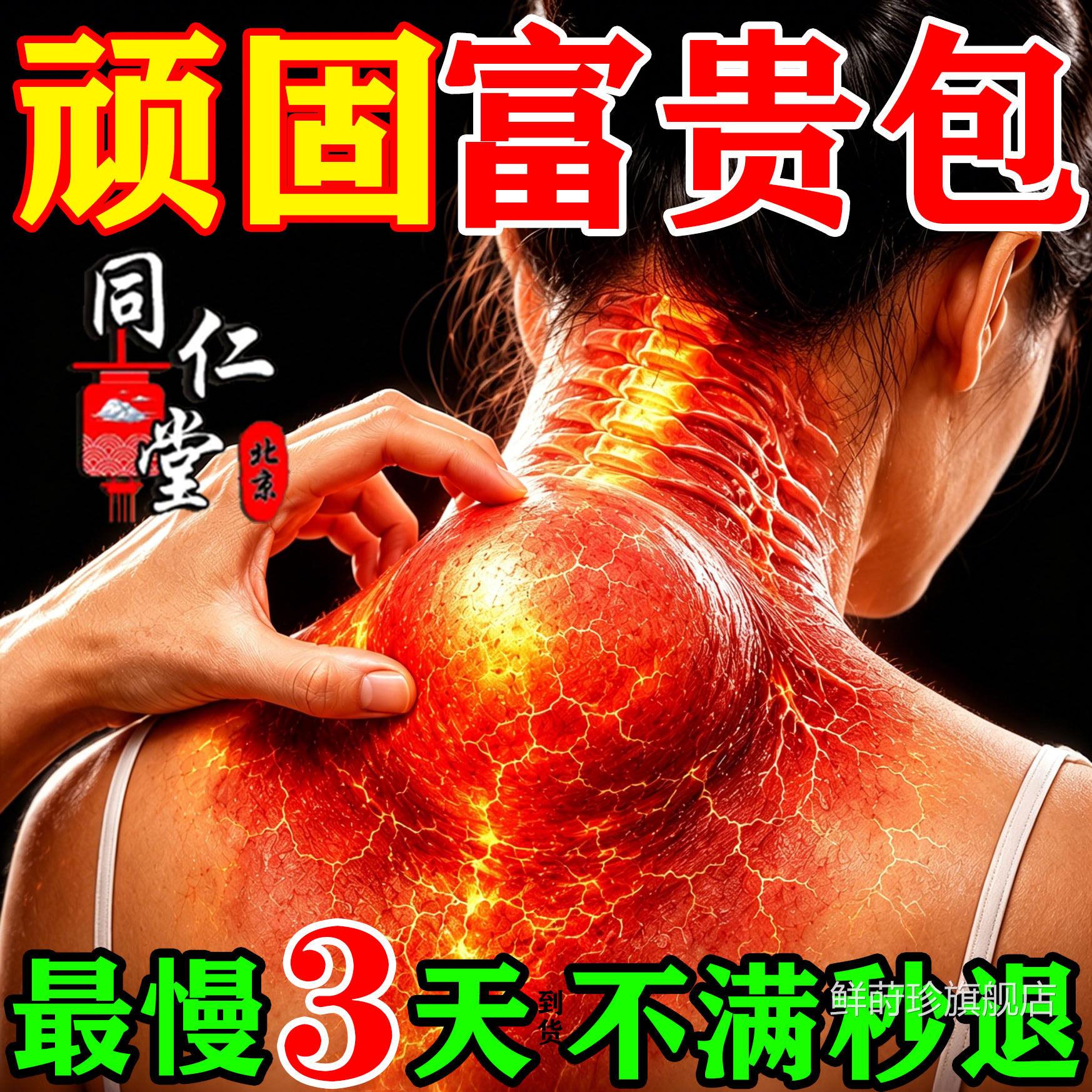 北京同仁堂富贵包肩颈酸胀膏药特压迫神经贴脖子鼓包热敷专用贴膏