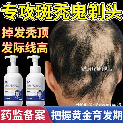 斑秃脱发效特鬼剃洗头药毛囊激活发生发液水增发密发排行榜名鲜莳