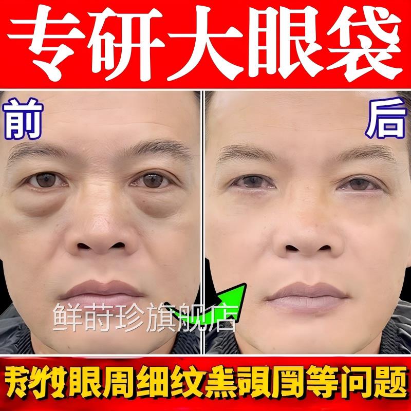眼排肿膏消液严重肿强力袋去眼消除袋神男士器一分钟克专用霜星鲜