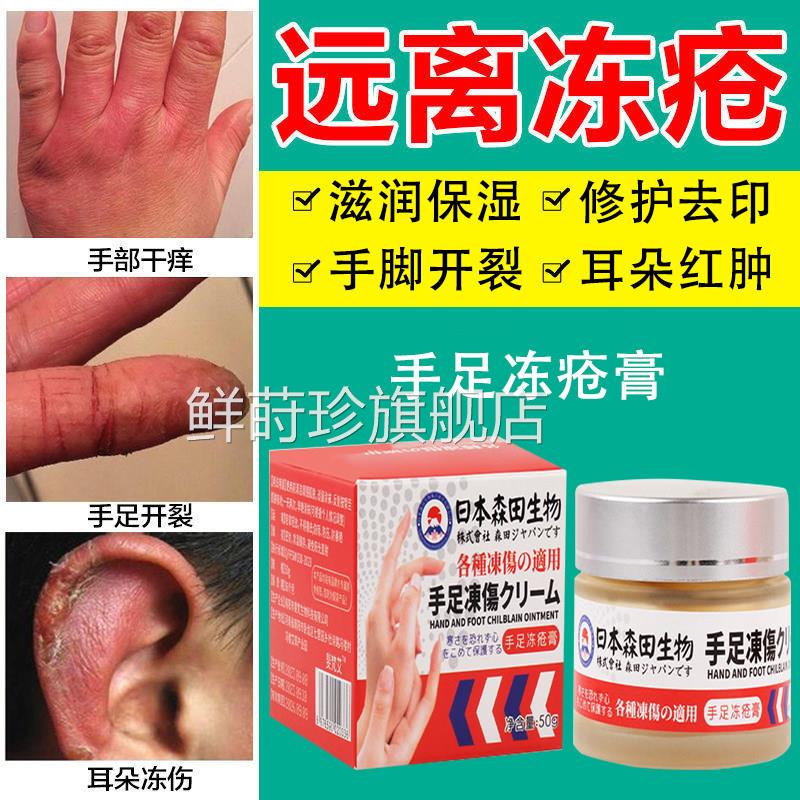 冻疮止痒冻伤膏药正膏品防裂膏防冻冻手足耳朵红肿痒日本特效鲜莳