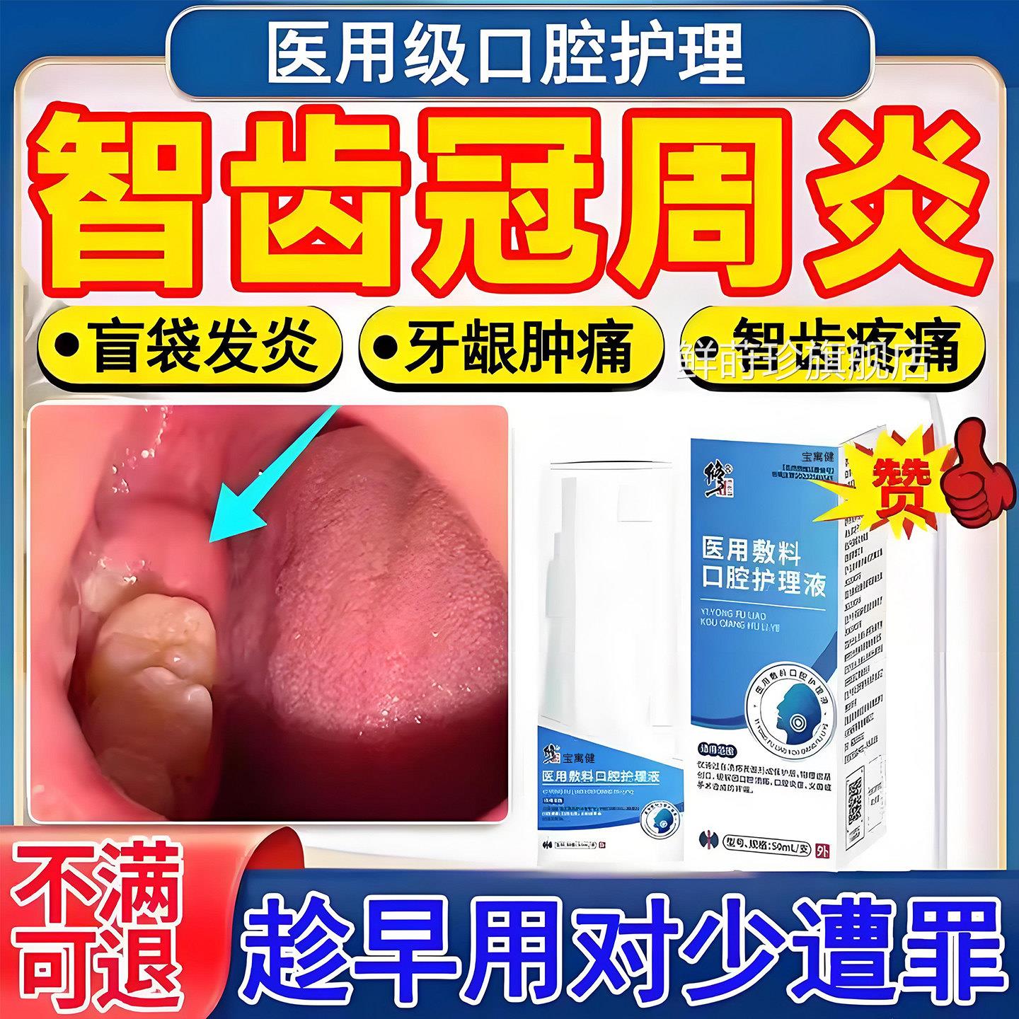 智齿冠周炎发炎漱口痛水牙龈牙根上火消炎牙齿肿喷雾剂药房同售鲜