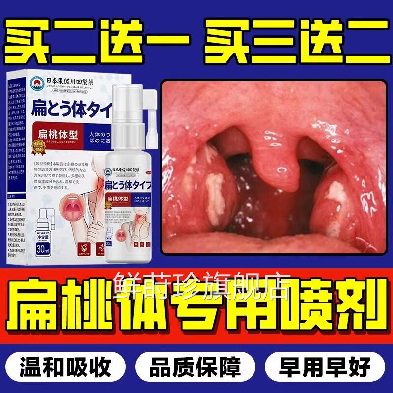 日本特效扁桃体结石去除工具漱口水喷雾剂溶解隐窝冲洗清器理喷剂