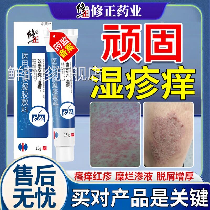 湿毒清软膏湿祛湿z痒皮根官方旗舰店湿毒止痒去肤液专用除湿膏YS